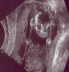 2004 11 23 Ultrasound1 - Face