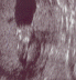 2004 11 23 Ultrasound2 - Foot