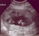 2004 11 23 Ultrasound3 - Hands