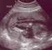 2004 11 23 Ultrasound4 - Feet