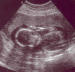 2004 11 23 Ultrasound5 - Head and Body