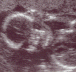2004 11 23 Ultrasound6 - Face